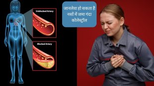 High Cholesterol Symptoms । High Cholesterol । bad cholesterol signs