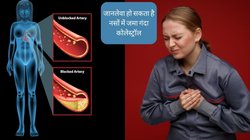 बॉडी में दिखें ये लक्षण तो समझ जाएं खतरे के निशान से ऊपर पहुंच गया है गंदा कोलेस्ट्रॉल, कभी भी काम करना बंद कर सकता है दिल