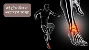 Guggul Benefits for Uric Acid । Guggul for Uric Acid । Uric Acid । Uric Acid Treatment । High Uric Acid