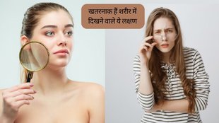 Diabetes symptoms । high blood sugar symptoms । Diabetes Treatment । Diabetes Control Tips