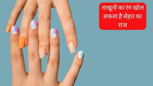 Nail Abnormalities । Nail Color । Healthy Nail Color । Healthy Nails Tips । Nail Growing Tips