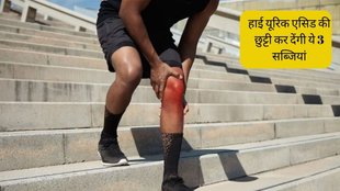 Uric Acid । Uric Acid Treatment । Uric Acid Vegetables । Uric Acid Home Remedies