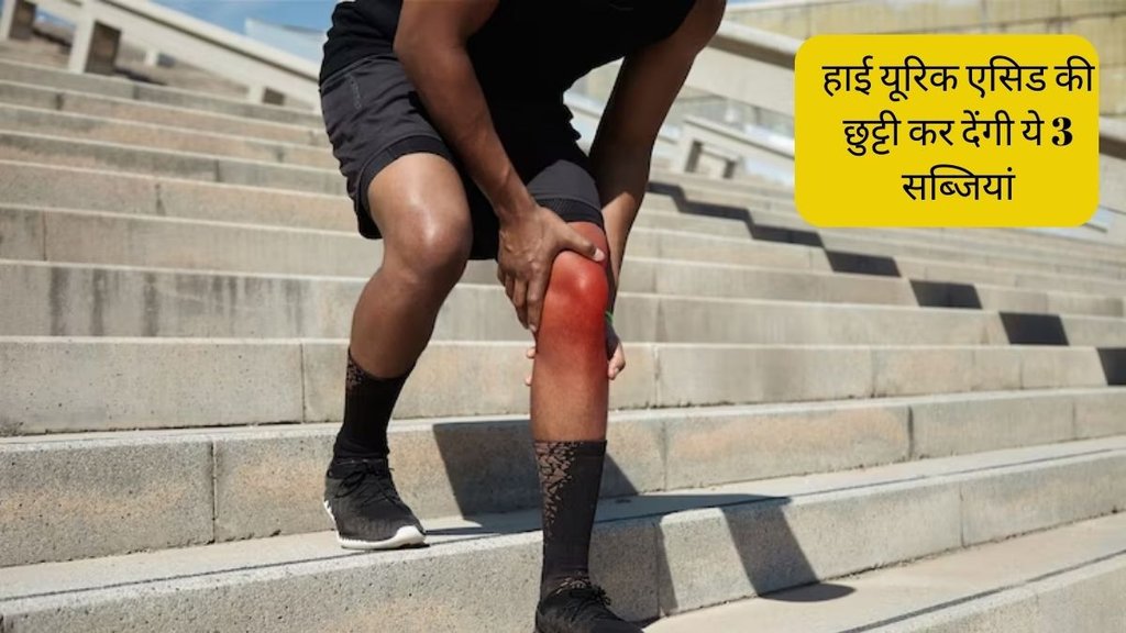 Uric Acid । Uric Acid Treatment । Uric Acid Vegetables । Uric Acid Home Remedies