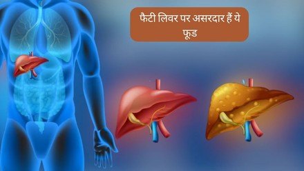 फैटी लिवर से हैं परेशान? आज ही अपनी डाइट में शामिल करें ये चीजें