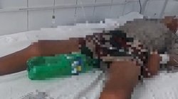 यूरिनल बैग नहीं मिला तो मरीज को लगा दी कोल्डड्रिंक की बोतल, बिहार के अस्पताल की तस्वीर वायरल