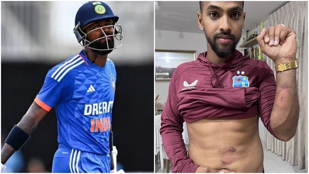 Hardik pandya। Nicholas pooran। India vs West Indies। T20 series India vs West Indies