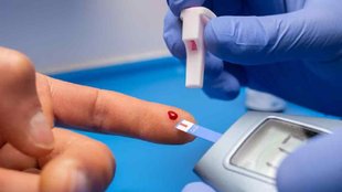 Postprandial Blood Sugar। Postprandial Blood Sugar Level। Postprandial Blood Sugar Test। PP blood sugar