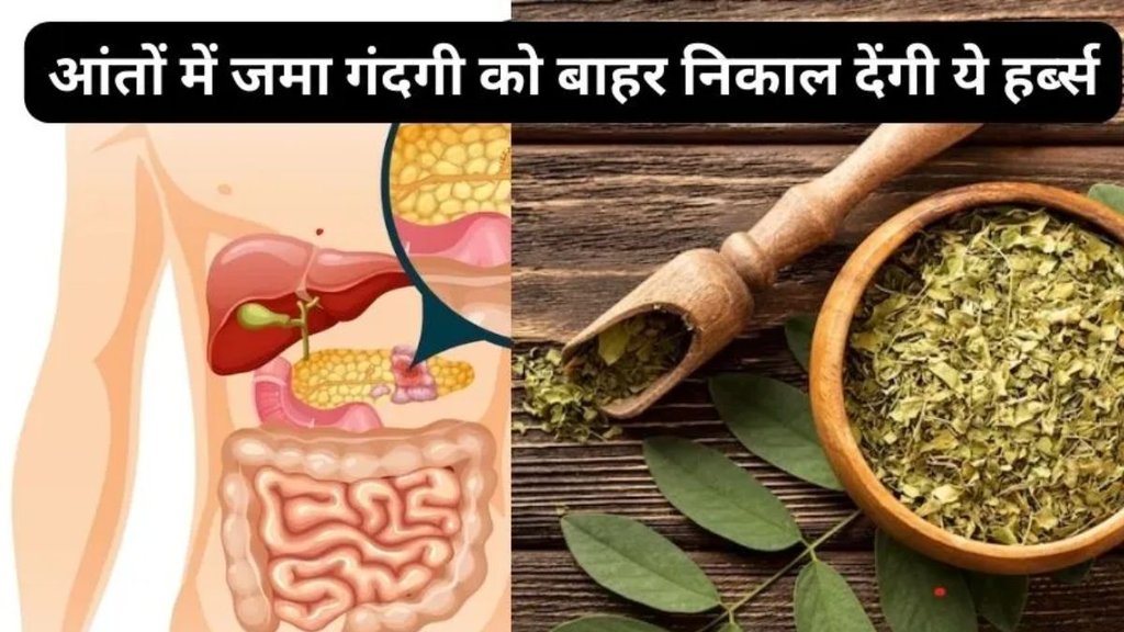 Ayurvedic Home Remedies, Home Remedies, Ayurvedic, Ayurved, Ayurveda, Constipation And Acidity, Constipation, Acidity, Ayurvedic Remedies, Ayurvedic Remedies for Constipation,
