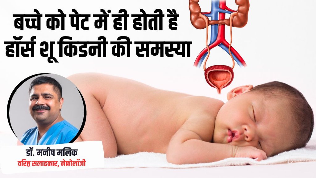 horseshoe kidney। horseshoe kidney cause,horse shoe kidney diagnose