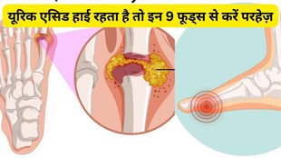 uric acid cause and home remedies, how to control purine intake, यूरिक एसिड, यूरिक एसिड बढ़ने का कारण