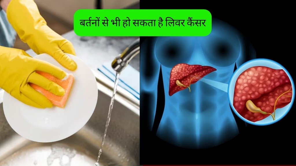 Liver Cancer । Liver Cancer Risk । Liver Cancer Causes