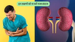 Kidney Failure Symptoms । Kidney Disease । Signs of kidney problems । Kidney Disease Symptoms In Hindi
