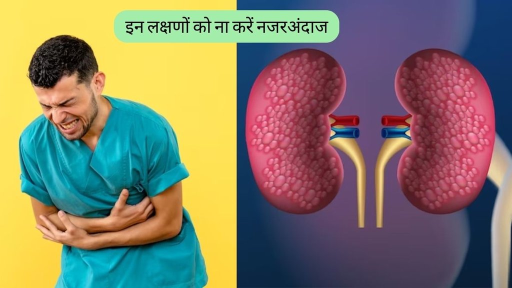 Kidney Failure Symptoms । Kidney Disease । Signs of kidney problems । Kidney Disease Symptoms In Hindi
