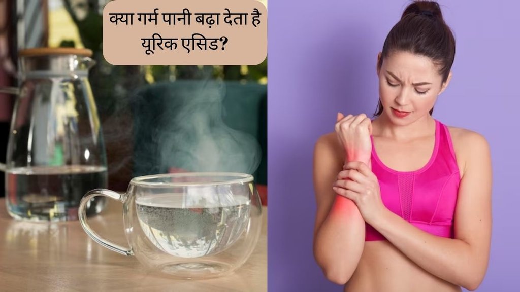 Uric Acid । Uric Acid Treatment । Warm Water In Uric Acid