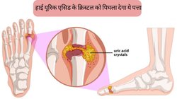 Uric Acid Treatment in Ayurveda: हाई यूरिक एसिड का रामबाण इलाज है ये मैजिक लीफ, इस तरह करेंगे सेवन तो कभी नहीं होगी जोड़ों में दर्द की समस्या