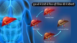 क्या ब्रश करते वक्त आपके मसूढ़ों से भी आता है खून? लिवर की खतरनाक बीमारी का लक्षण है ये, युवाओं को तेजी से बना रही शिकार