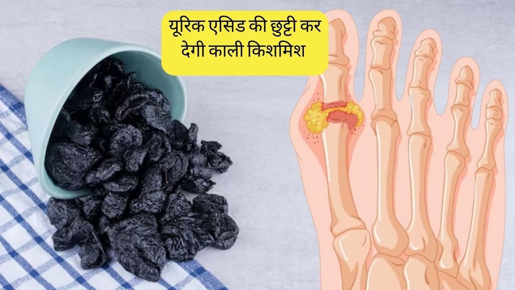 Black raisins Benefits । Black raisins For Uric Acid । Uric Acid