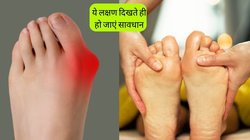 उंगलियों की तरफ मुड़ने लगा है पैरों का अंगूठा, हर वक्त सूजती हैं उंगलियां तो हो जाएं सावधान, इस गंभीर बीमारी के हो सकते हैं लक्षण