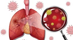World Lung Cancer Day 2023: फेफड़ों में जमा पॉल्यूशन और बीड़ी-सिगरेट की गंदगी को जड़ से साफ कर सकते हैं ये 3 योगासन, दूर रहेगा लंग्स कैंसर का खतरा