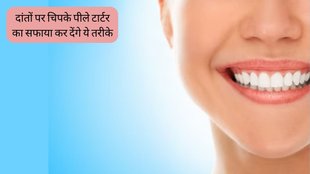 teeth whitening at home । Dental Health Tips For Monsoon । DIY teeth whitening remedies । Home remedies for a brighter smile