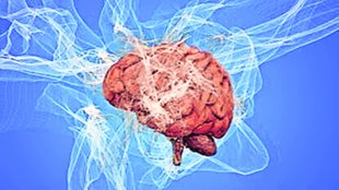 Alzheimers | disease