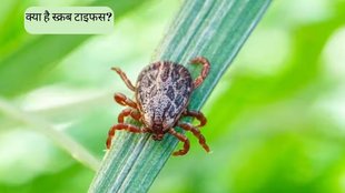 Scrub Typhus । Scrub Typhus Symptoms । Scrub Typhus Treatment