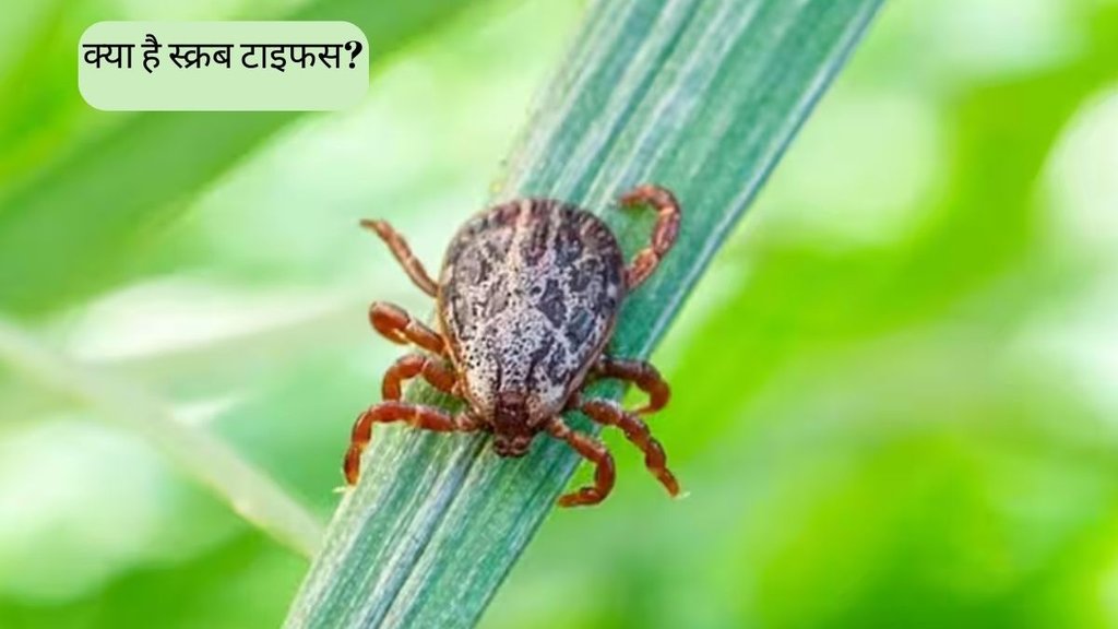 Scrub Typhus । Scrub Typhus Symptoms । Scrub Typhus Treatment