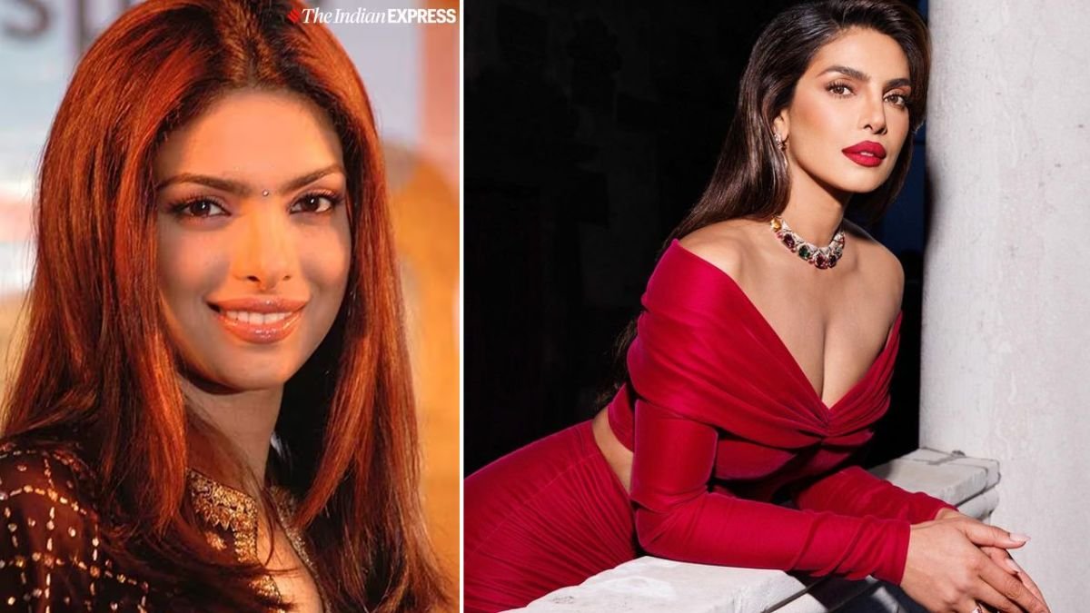 Priyanka Chopra Nose Surgery