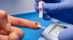Diabetes: डायबिटीज के मरीजों के लिए किसी औषधि से कम नहीं है पीले रंग का ये खूबसूरत फूल, तेजी से कम करता हैं इंसुलिन रेजिस्टेंस, जानें कैसे करें सेवन