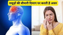 मसूड़ों की Cavity और प्लाक को अनदेखा करने पर बढ़ सकता है डिमेंशिया का खतरा, क्या कहती है मेडिकल साइंस, जानिए कैसे करें गम का बचाव