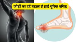 Uric Acid बढ़ने से हाथों और पैरों की उंगलियां हो सकती है टेढ़ी, पैर की बड़ी उंगली का दर्द कर सकता है बुरा हाल, इन 3 उपायों से करें दर्द का उपचार