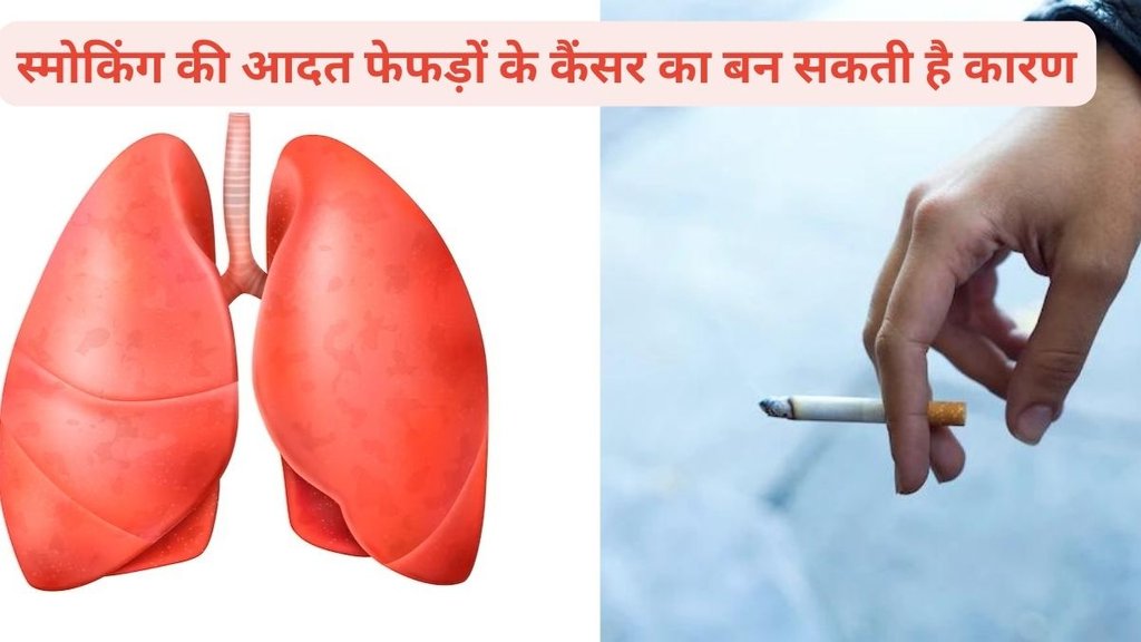 Lung cancer causes,Lung cancer diagnosis,Lung cancer symptoms,फेफड़ों के कैंसर, फेफड़ों के कैंसर का कारण, फेफड़ों के कैंसर से कैसे बचाव करें
