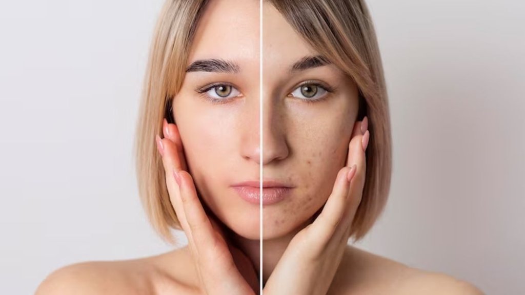 ,pigmentation cream,Pigmentation cure,pigmentation door karne ka tarika,pigmentation door karne ke tareeke,pigmentation face packs,pigmentation diet chart,
