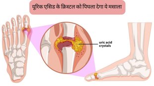 Black Pepper for Uric Acid । Kali Mirch benefits । Kali Mirch For Uric acid