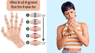 Arthritis । Arthritis Pain । Arthritis Remedy । Gout