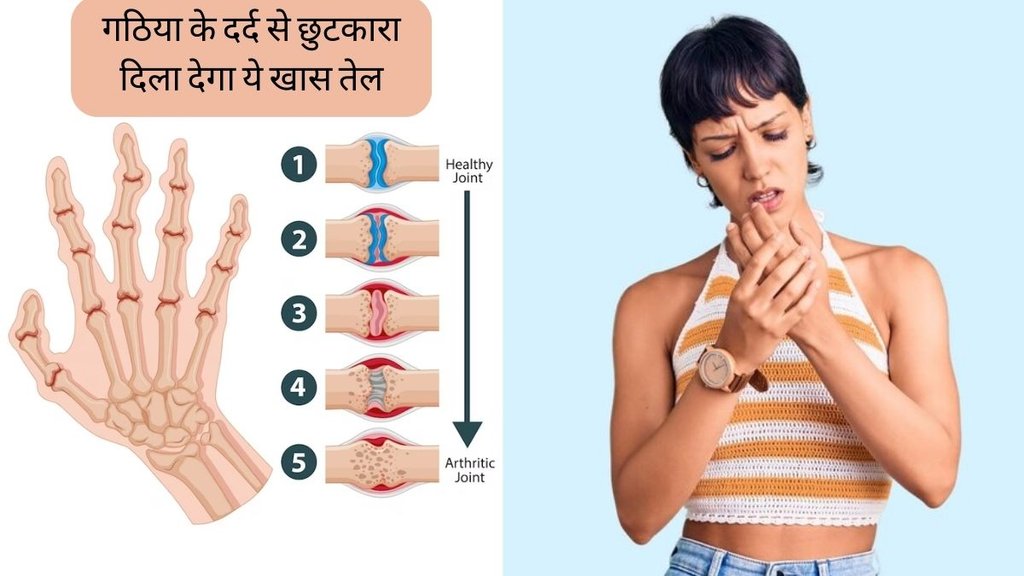 Arthritis । Arthritis Pain । Arthritis Remedy । Gout