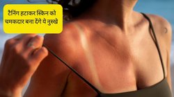 स्किन पर मैल जैसी भद्दी दिख रही है जिद्दी टैनिंग? पार्लर के खर्च से बचने के लिए घर पर ही अपना लें ये आसान नुस्खे, खिल उठेगी त्वचा