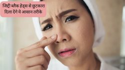 Blackheads Remedies: नाक और गाल पर बेहद भद्दे लगते हैं ब्लैक हेड्स? इन 3 आसान तरीकों से करें सफाया, बच जाएगा पार्लर का खर्चा