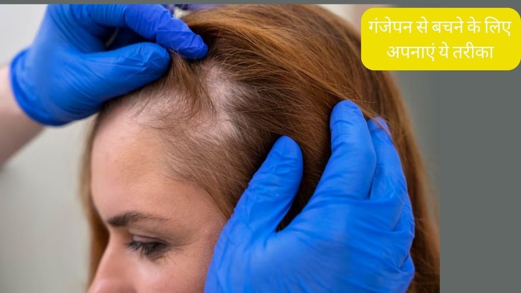 Hair baldness । Spray For Hair growth । Hair Care Tips