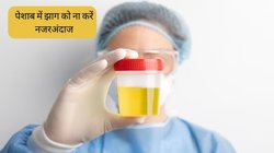 पेशाब में झाग को आम समझने की ना करें गलती, इन गंभीर बीमारियों का हो सकता है लक्षण, लगातार होने पर तुरंत भागें अस्पताल
