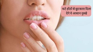 Lip Care । Dry Lips । Chapped Lips Remedies