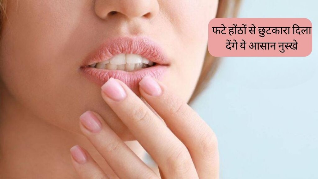Lip Care । Dry Lips । Chapped Lips Remedies