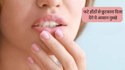 रूखे-फटे होंठों से मुस्कुराने पर भी होता है तेज दर्द? सोने से पहले कर लें ये आसान काम, गुलाब की पंखुड़ियों जैसे मुलायम हो जाएंगे Lips