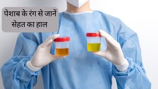 Urine Color । Urine Color Signs । Health News