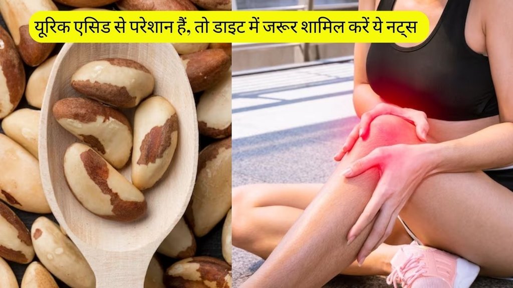 Nuts For Uric Acid । Uric Acid । Uric Acid Remedies