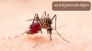 Dengue । Dengue Hemorrhage Shock Syndrome । DHSS