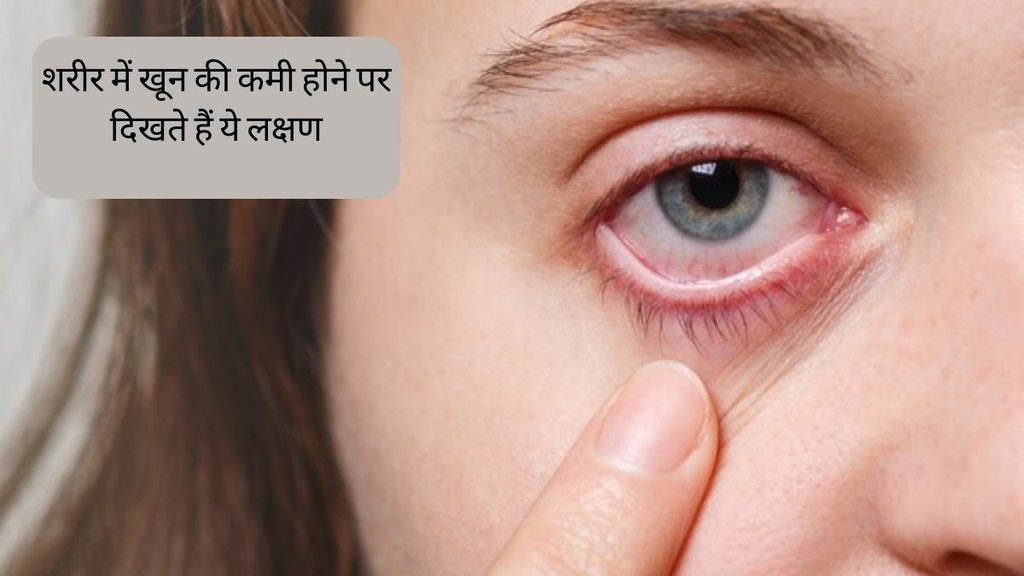 Anemia Symptoms । iron deficiency । low blood count । low hemoglobin symptoms