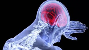 Brain stroke| disease