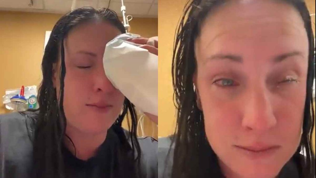 EYE II Viral Video II Trending News