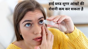 Chronic diabetes causes retinopathy, Chronic diabetes causes cataract, Chronic diabetes causes glaucoma, uncontrolled blood sugar can cause vision loss,